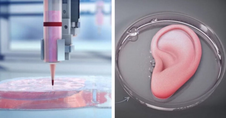 3D Printed organs